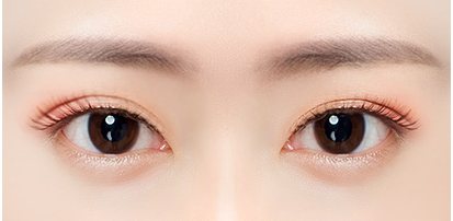 쌍꺼풀의 모양이 비대칭인 눈
