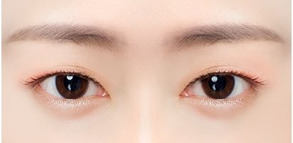 쌍꺼풀이 풀린 눈