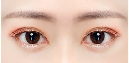 쌍꺼풀 라인이 여러 겹인 눈